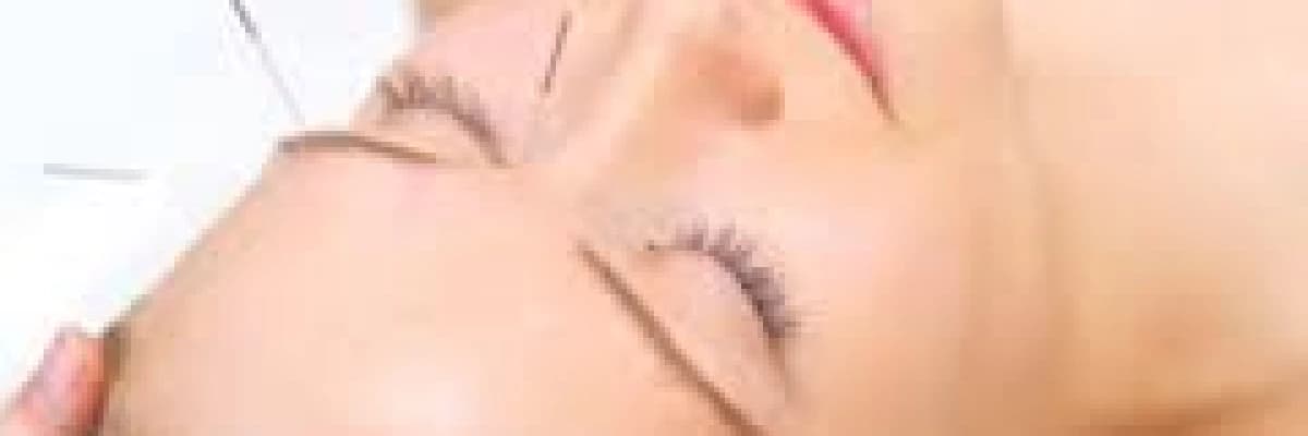 İğnenin ucundaki sağlık:akupunktur