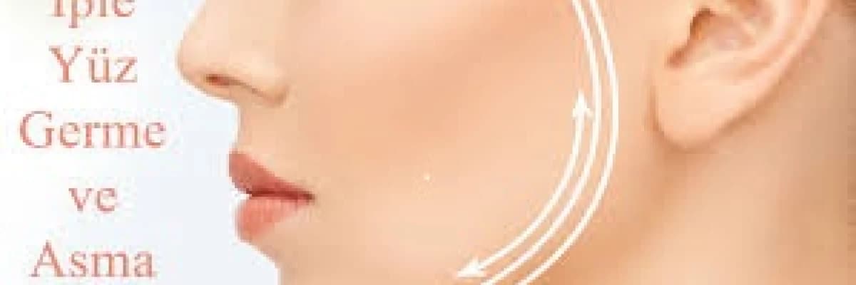 İple yüz gençleştirme hangi bölgelere uygulanır?