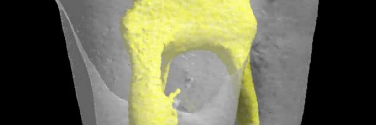 Dişlerin kendi kendini iyileştirme gizemi açıklığa kavuştu.