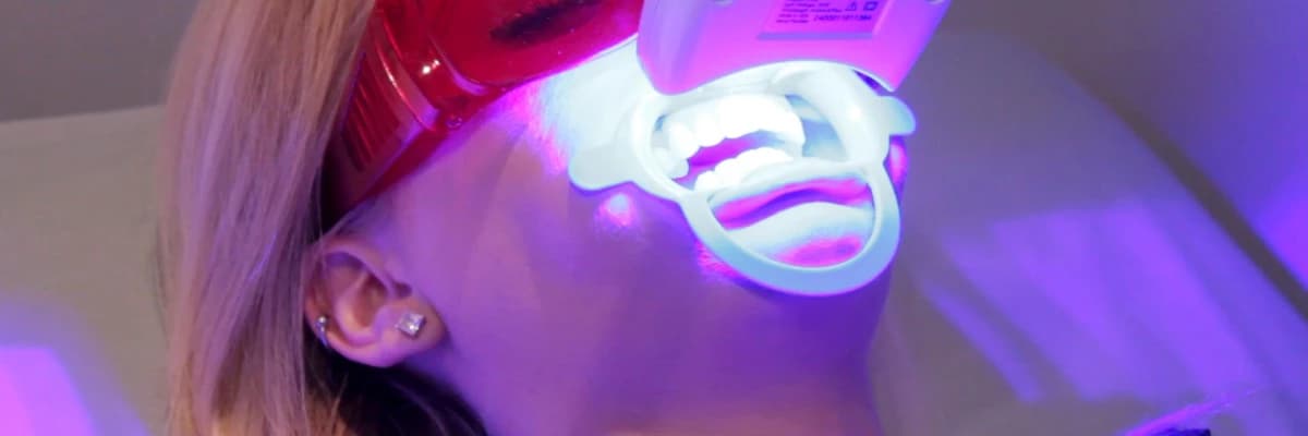 Estetik diş hekimliğinde beyazlatma uygulaması