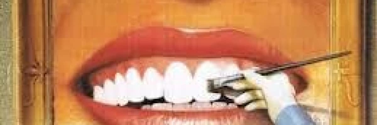 Gülüşte tasarım mümkün mü (smile designe)