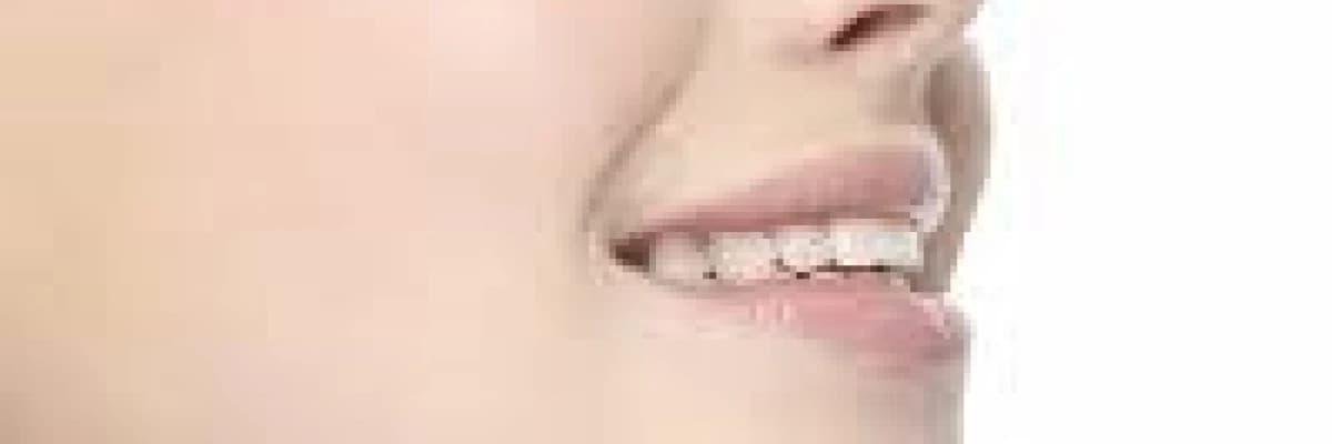 Yüz germede kullanılan teknikler nelerdir?