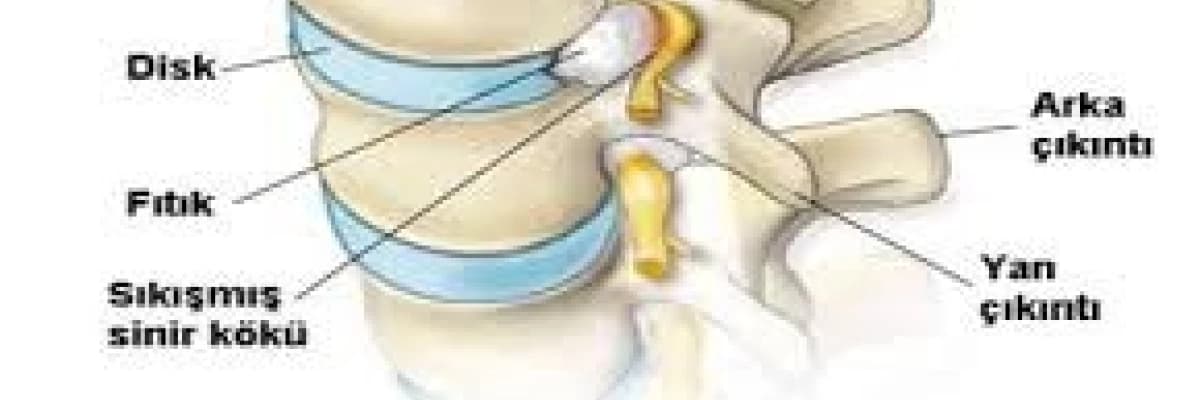 Bel ağrısı nedenleri ve algolojide tedavisi