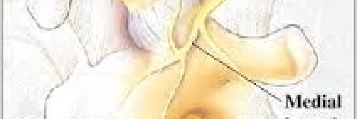 Faset Eklem Blokajı – Faset Medial Dal Blokajı ve RFT