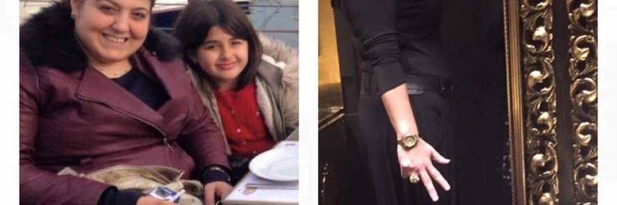 Tüp Mide Operasyonu