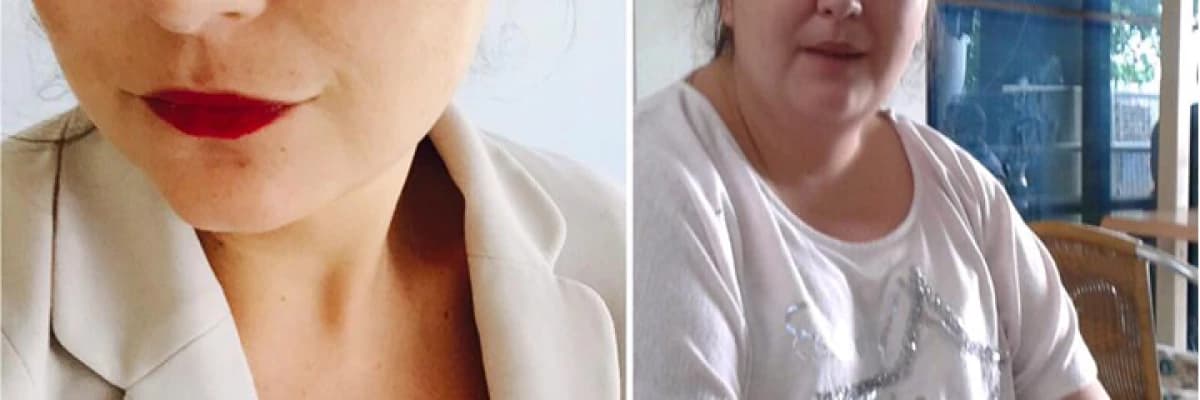 OBEZİTE VE DİABET CERRAHİSİ ÖNCESİ GÖRÜŞMELER NASIL BİR SÜREÇ EŞLİĞİNDE GERÇEKLEŞTİRİLİR?