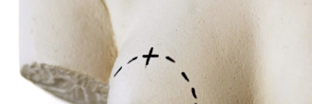 Meme Estetiği | Meme Büyütme Ameliyatı | Silikon Protez