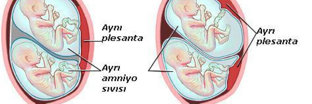 Çoğul ve İkiz Gebelik