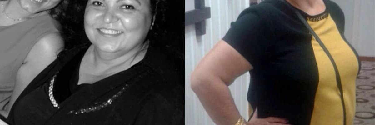 Obezite ameliyatı herkese uygun mudur?