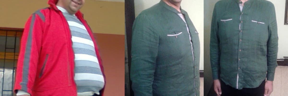 Diyabet Hastalığına  cerrahi çözüm