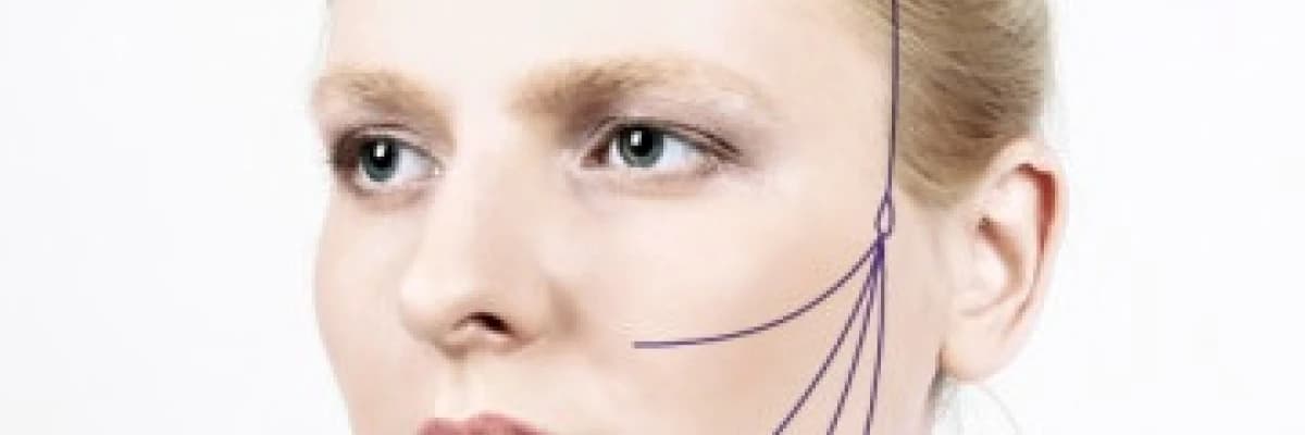 "KİLİT ASKI" yöntemi ile yüz germe hakkında bilgiler