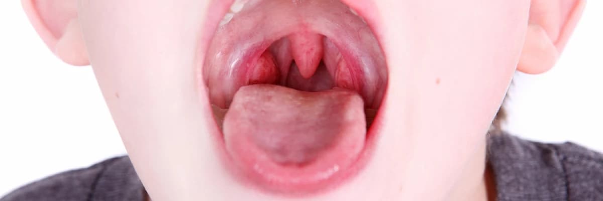 Geniz Eti ve Bademcik Hakkında Yanlış Bilinenler