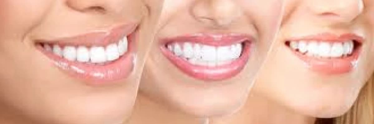 Dişeti ve Genel Sağlığımız