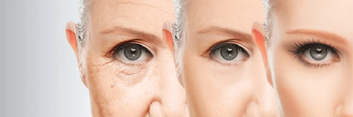 YÜZ GENÇLEŞTİRME NEDİR?