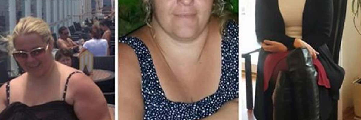 OBEZİTE CERRAHİSİNDE DİYET PSİKOLOJİSİ