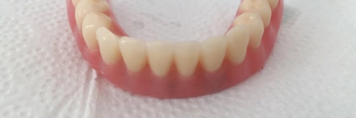 Diş Hekimliğinde teknolojik olarak geldiğimiz en önemli nokta, İMPLANT