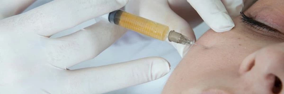 PRP (Platelet Rich Plasma),