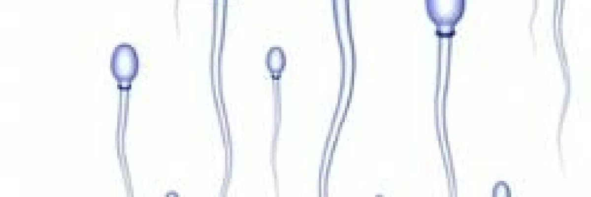 Vazektomi(Erkekte Kanalların Bağlanması)