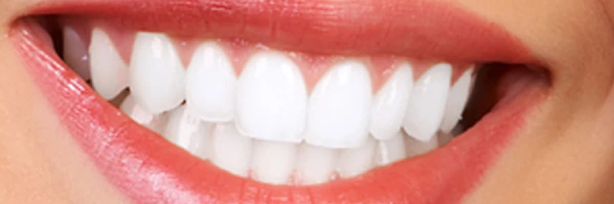 Estetik Dişler ve Gülüş Tasarımı