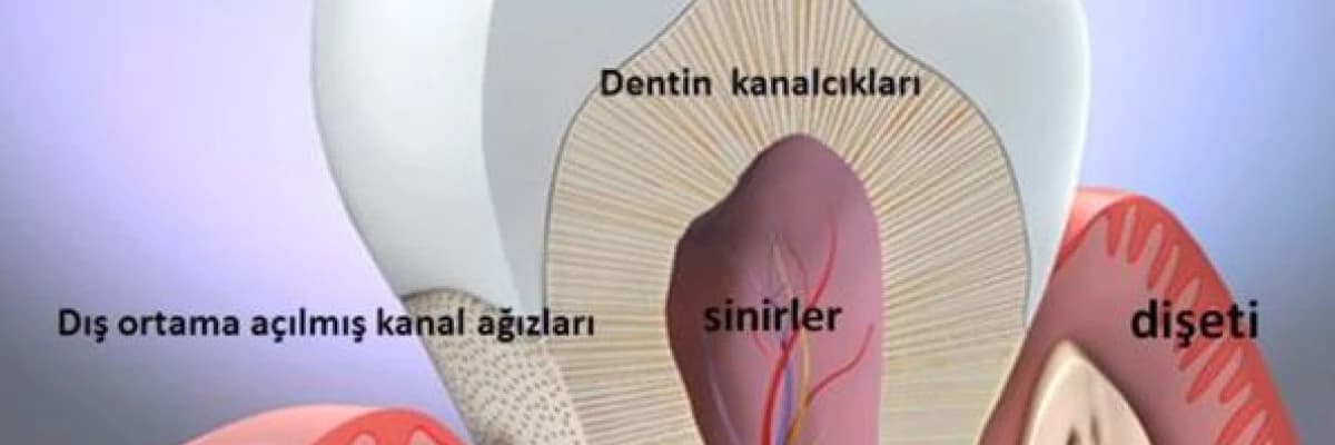 Diş Hassasiyeti Tedavisi Hakkında Bilgiler