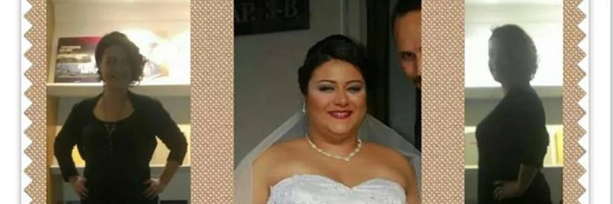 Obezite ve Diyabet’te Kilo Kaybı