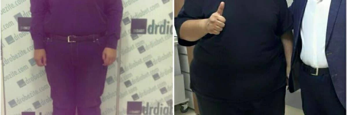 Morbid Obezite İle İlişkili Hastalıklar