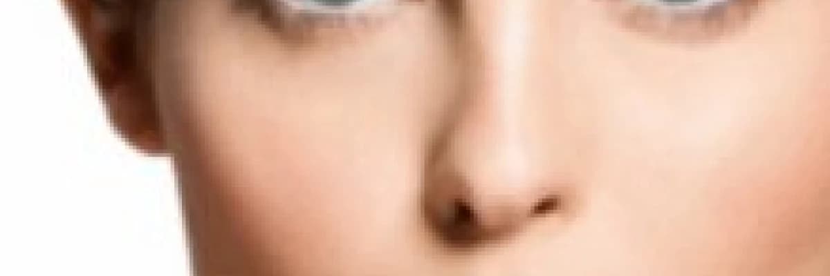 ESTETİK ALIN VE ŞAKAK GERME