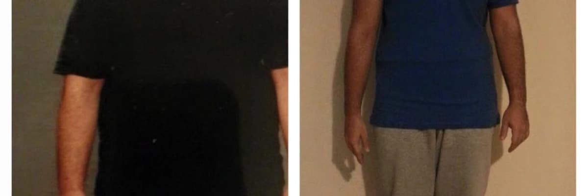 Obezite Cerrahi Sonrası Altın Kurallar