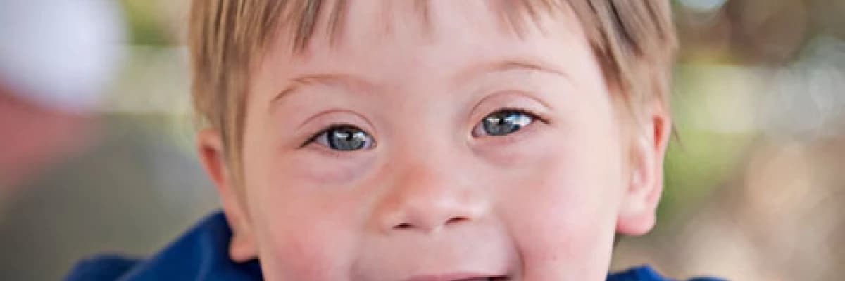 DOWN SENDROMLU ÇOCUKLARDA GÖZLENEN DAVRANIŞLAR HAKKINDA...