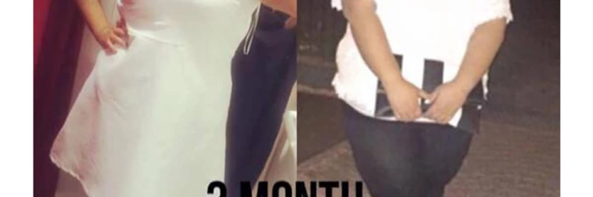 Obezite Cerrahisinde Multidisipliner Yaklaşım