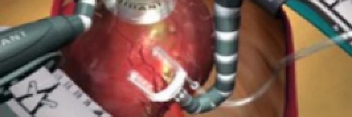 Çalışan Kalpte Baypas