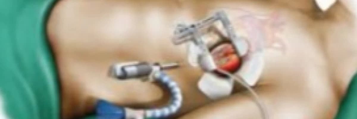 Geleneksel ve Minimal İnvaziv Kalp Cerrahisi