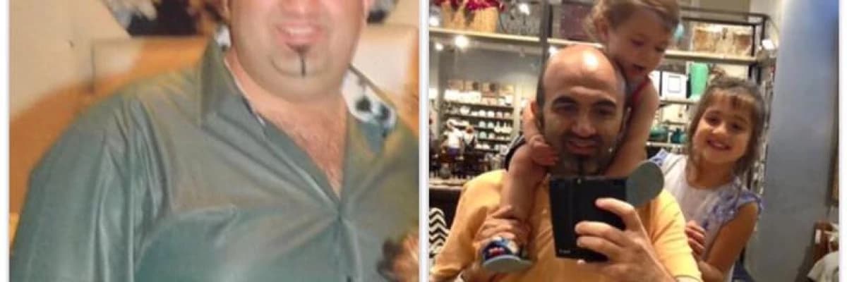 Obezite Hastalığı Ve Sosyal Destek