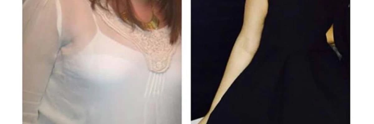 OBEZİTE VE METABOLİK SENDROM