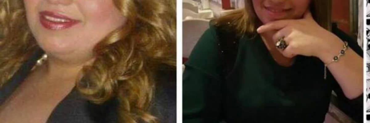 Obezite Cerrahisi Sonrası Ne Kadar Zayıflayacağım?