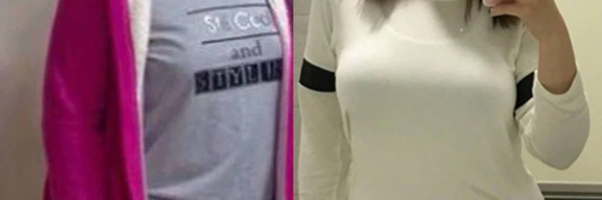 Obezite Ameliyatları Ve Sigara Alışkanlığı