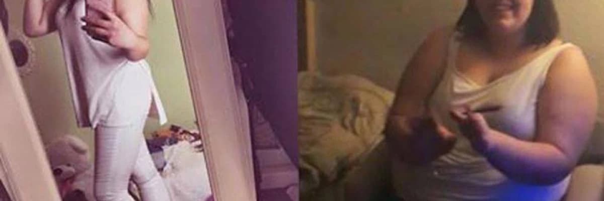 Ameliyat Öncesi, Ameliyat Esnasında ve Ameliyat Sonrasında Kaygı Artışları – 1