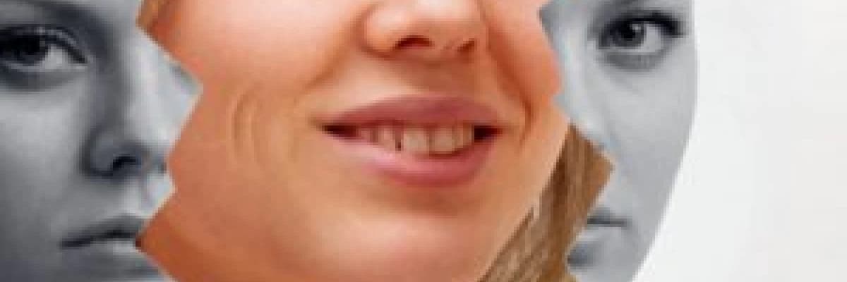 Bipolar bozukluk nedir? Tedavisi nasıldır?