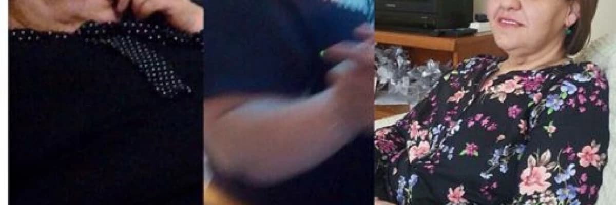 Haşimato Hastalığı, Hipotiroidi Ve Obezite