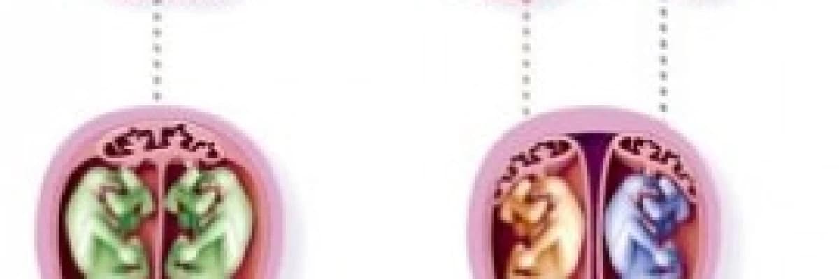 Çoğul Gebelikte Oluşan Komplikasyonlar ve Problemler