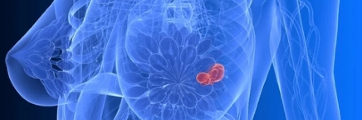 Obezite Meme Kanseri Riskini Arttırıyor!