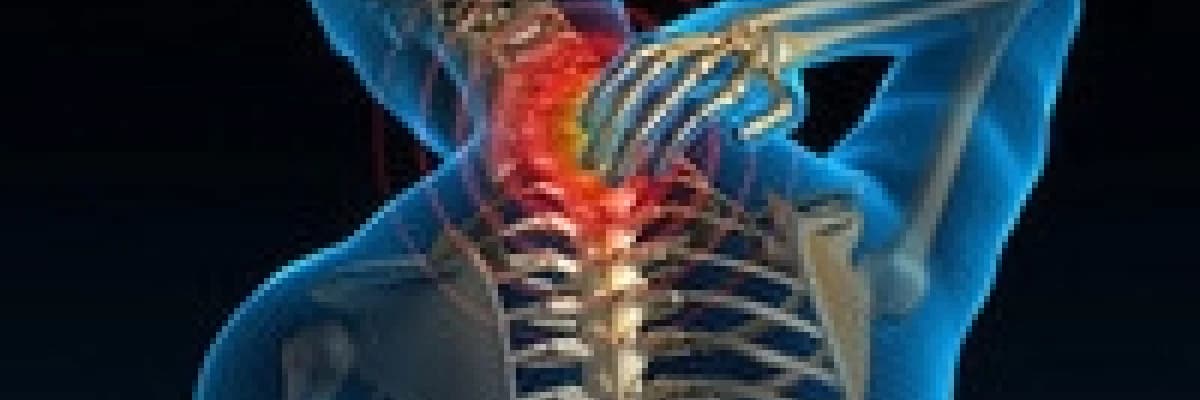 Boyun Ağrısı ve Tedavileri