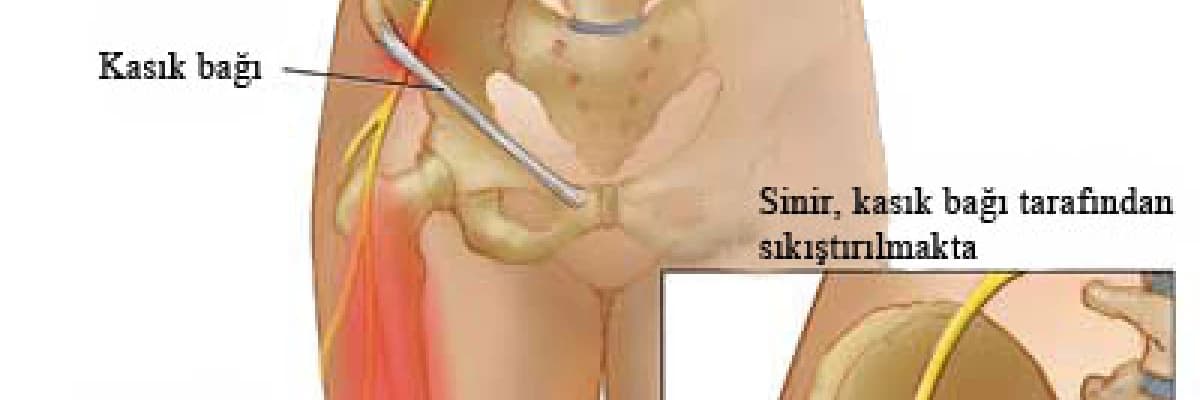 Meraljiya Parestetika Nedir? Tedavisi Nasıl Yapılır?