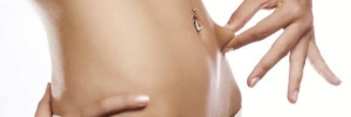 Karın Germe Ameliyatı (Abdominoplasti)