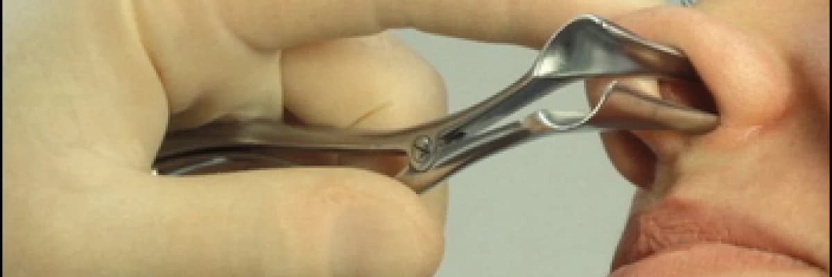 ALLERJİK RİNİTLER VE TEDAVİSİ