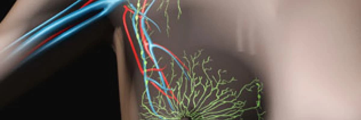 Meme kanseri ve tedavisi