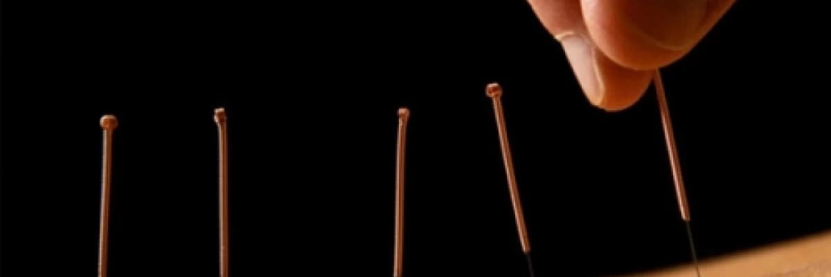 Akupunktur meme kanserinde lenfödemi azaltabilir!