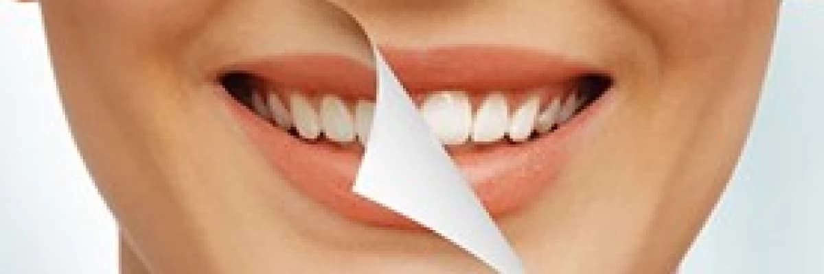 Gülüş Tasarımı Nedir? Nasıl Yapılır?