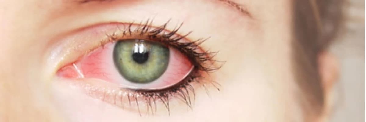 GÖZLERİNİZ KURU OLABİLİR Mİ?