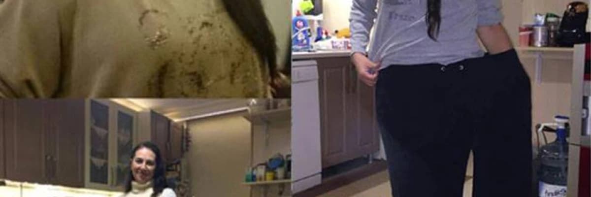 Şeker Hastalığı Ameliyatı Avantajları Nelerdir